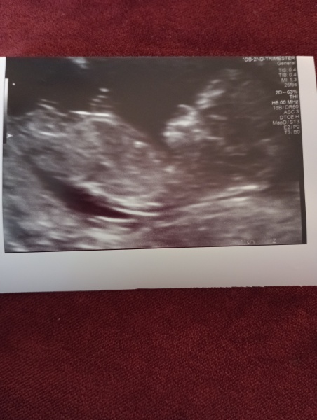 Gender scan Friday any guesses. I haven't a clue