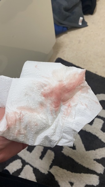 Bleeding 6 weeks - sensitive images