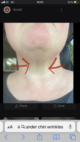 Under chin pleats