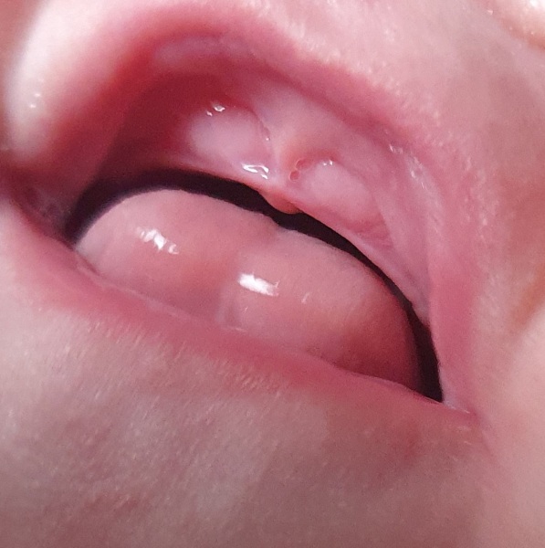 Is this baby teething?