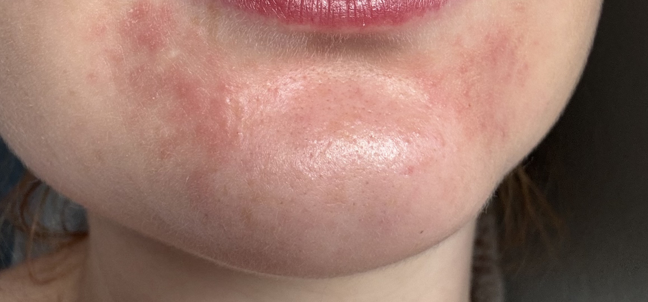 Can anyone help with my skin issue?