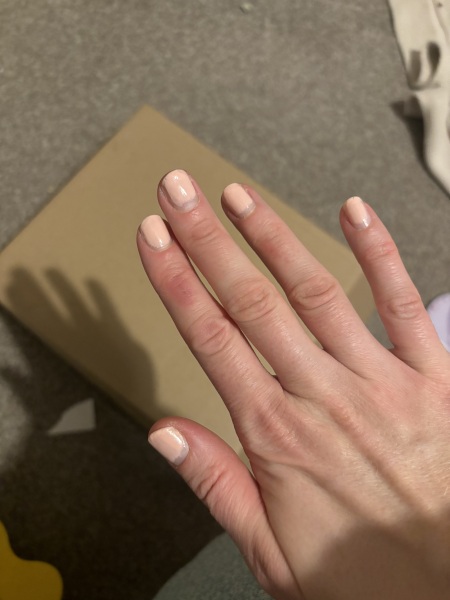 Gel nail recovery