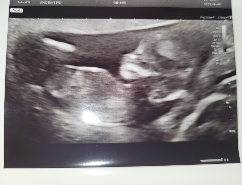 Due June 24?