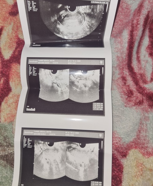 I don't know if I'm pregnant or not