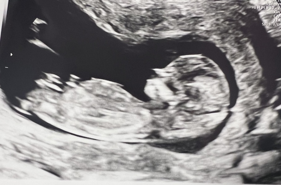 Due May 2024? Part 2