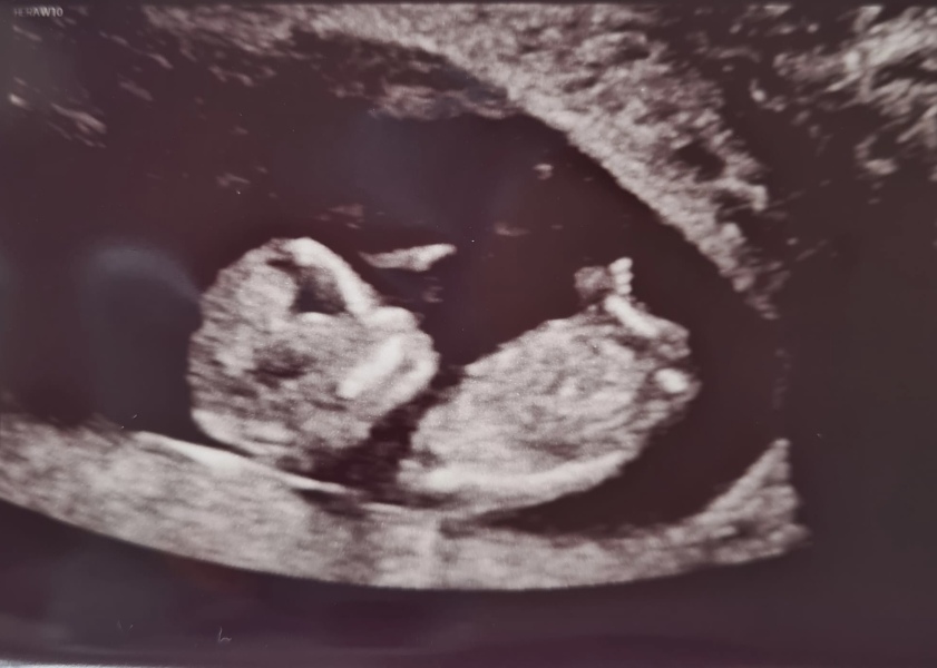 Boy or girl??