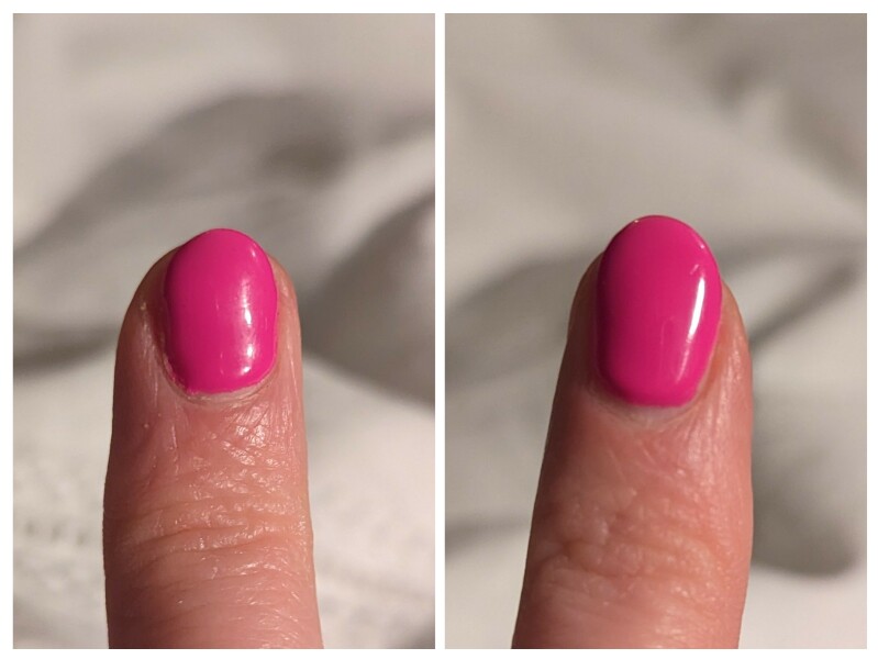 Have you ever lost your whole fingernail (no pic don't worry)