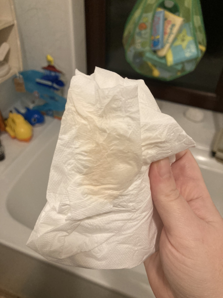 'Pregnancy after Miscarriage - Latest support thread'