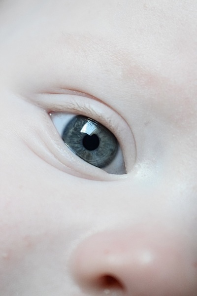 Eye colour change after 6 months? Eyes look multicoloured.
