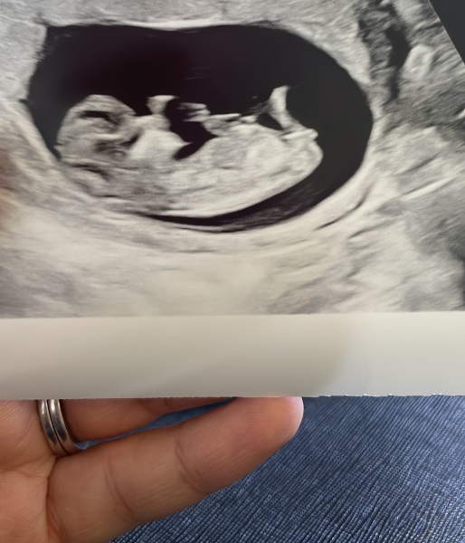 Gender guesses