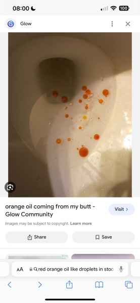 Orange/red oil drops whilst pooping. (GOOGLE IMAGE ATTACHED)