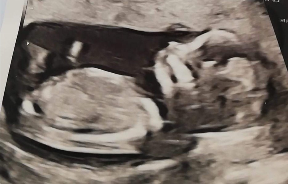 Gender
