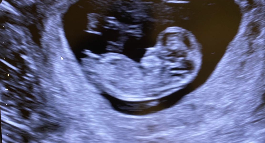 Gender guesses