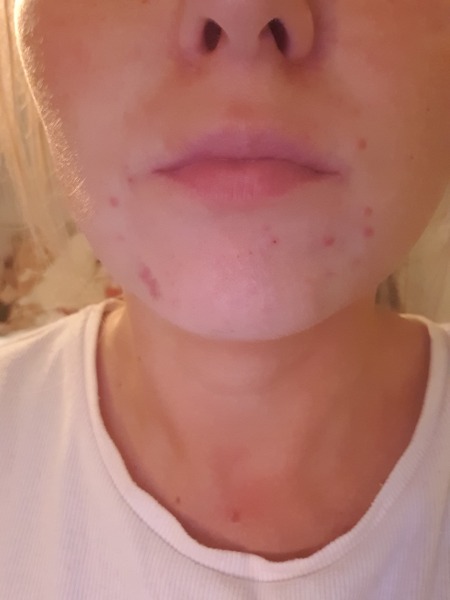 Wnat are these spots on my skin???