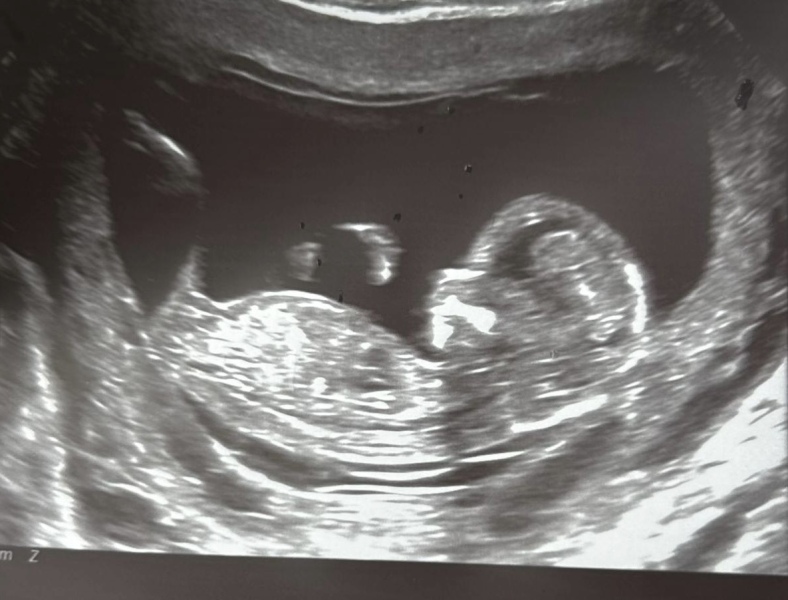 Boy or girl? 💙 🩷