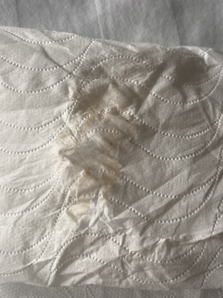 Wiping tinged with blood 6 weeks 4 days - what to do [pic attached]