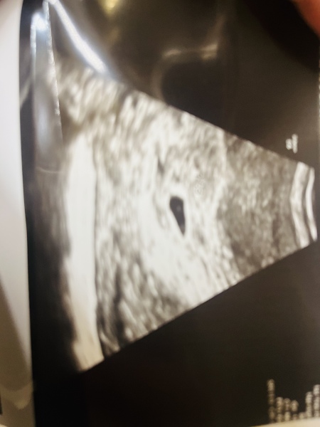 Early scan 2dots