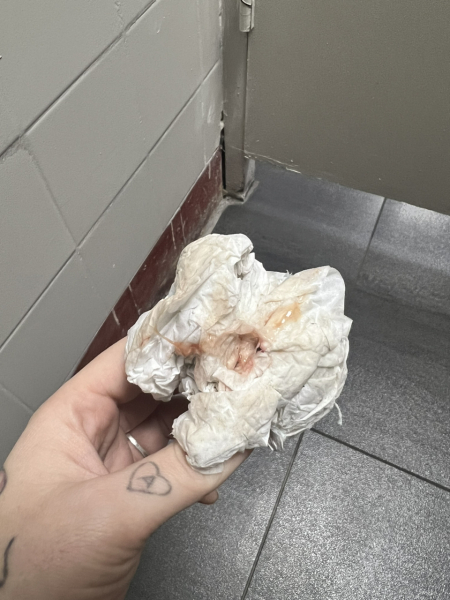 Could this be implantation! GRAPHIC PHOTO