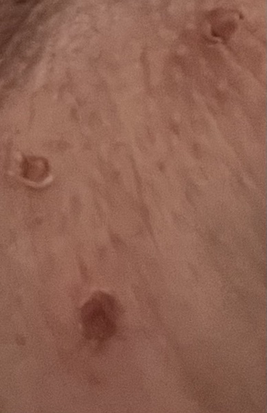 Please help: PHOTO AT END OF POST do not open if you would rather not see