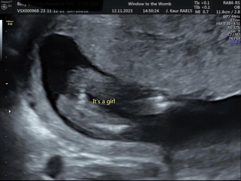 Is this definitely a girl?