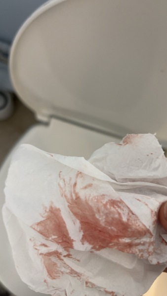 Is this implantation bleeding? (Pic warning)