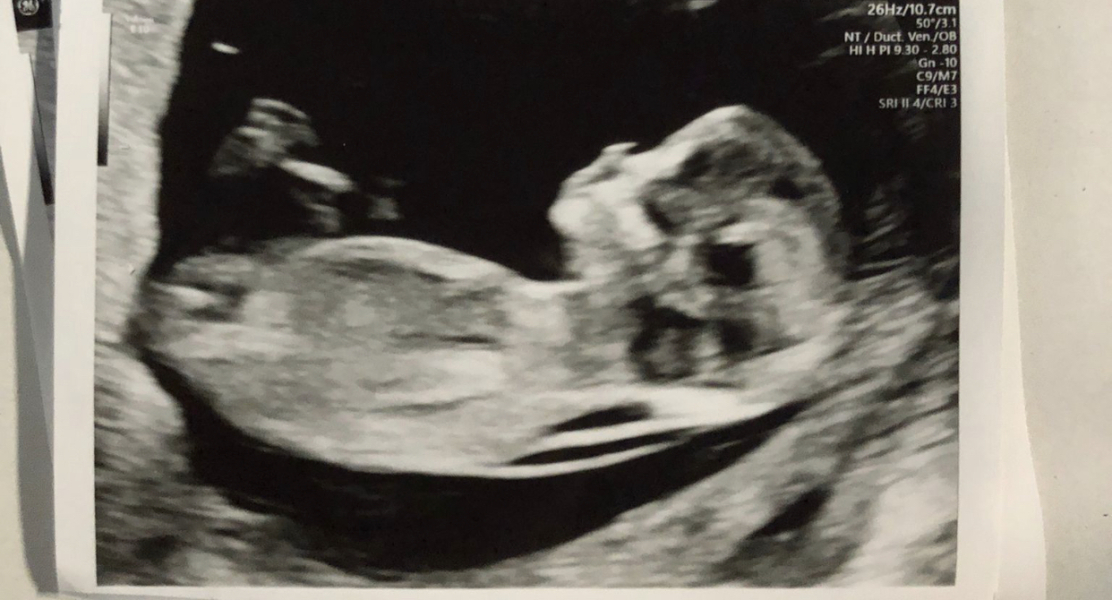 Just for fun. Anyone guess gender? 