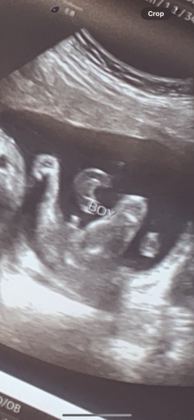 Is this definitely a boy before I tell my family today?