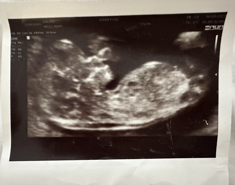 Boy or girl? Anyone good at guessing from scan picture?
