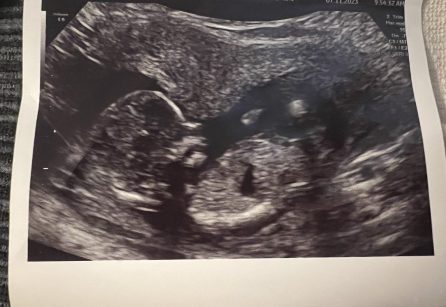 Boy or girl