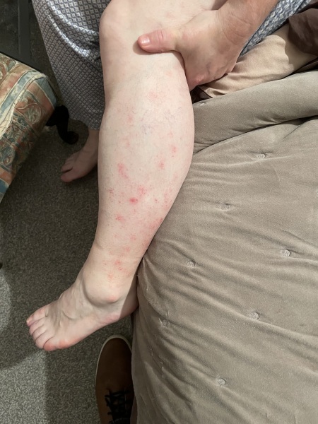 Please help - what is this rash