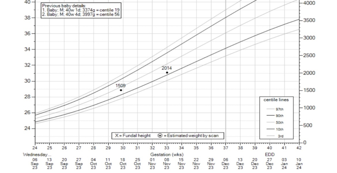 GROW chart