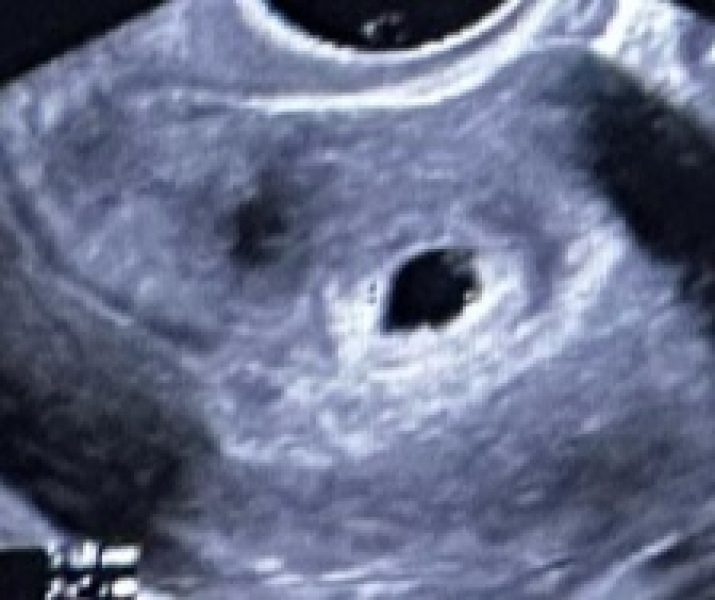Scan