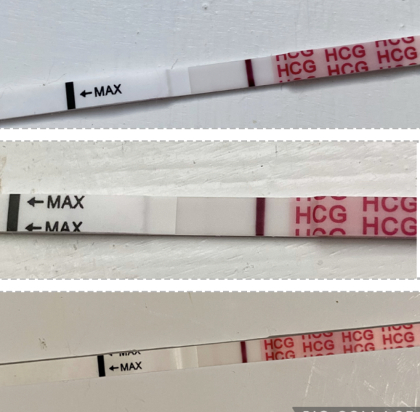 Several wondfo positives with progression, negative frer