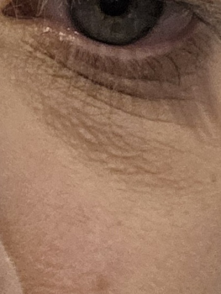 Help for under eye care/improvements