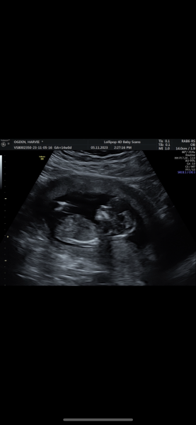 Has a gender scan ever been wrong for you?