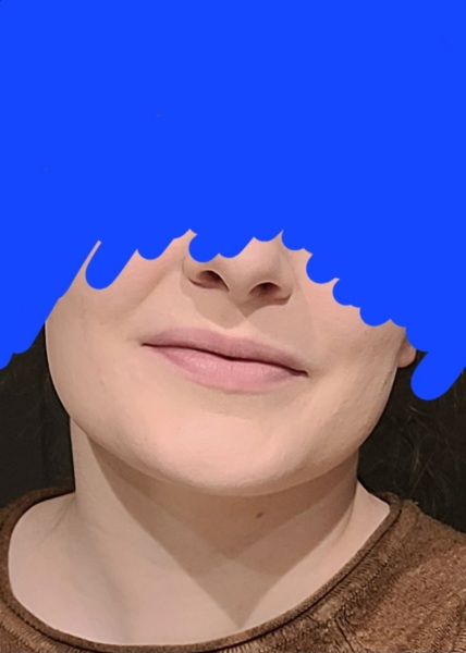 What is with lip fillers?!? They look so fake and awful