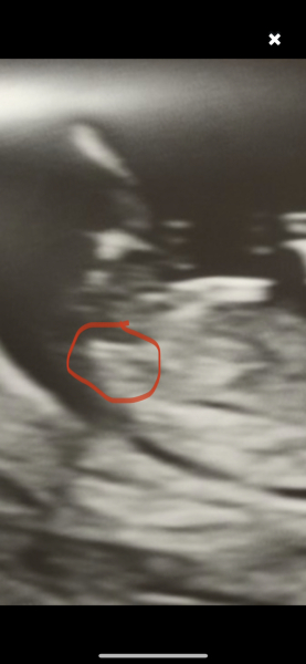 Can you see a nub? A hint of one?