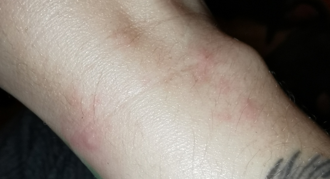 Can you be allergic to an artificial Christmas Tree??