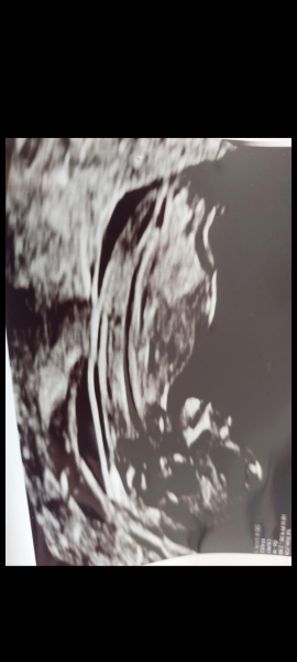 Nubologists question - any experiences?