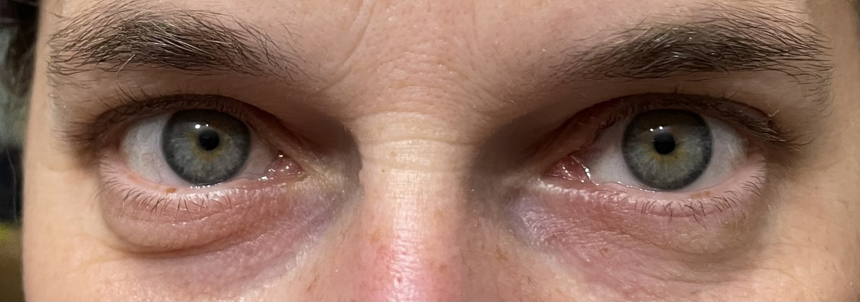 Eye colour