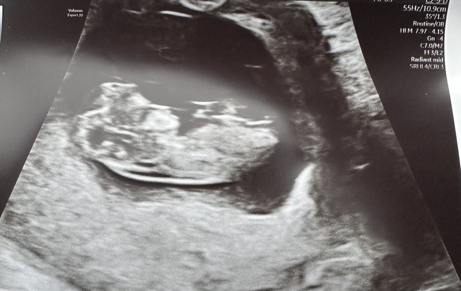 Gender Guesses!