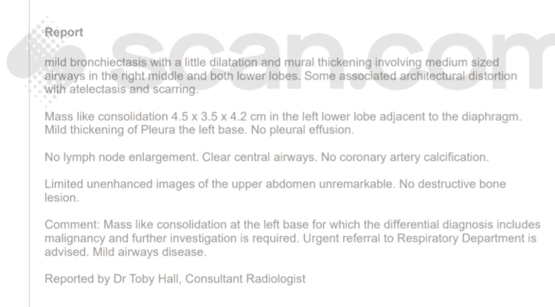 URGENT. Any radiologists/oncology people here?