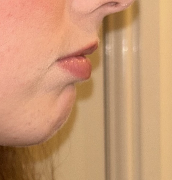 To be upset dentist said this about my teeth (pics included)