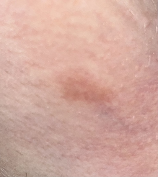 What is this red patch?