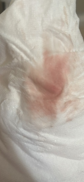 Implantation bleeding? So confused