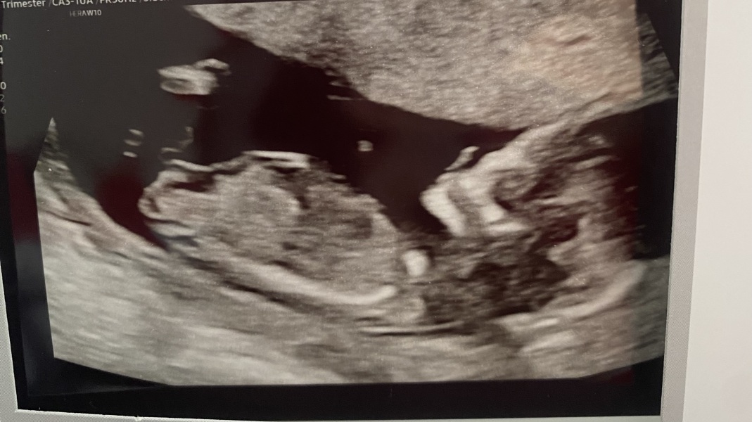 Any guesses?