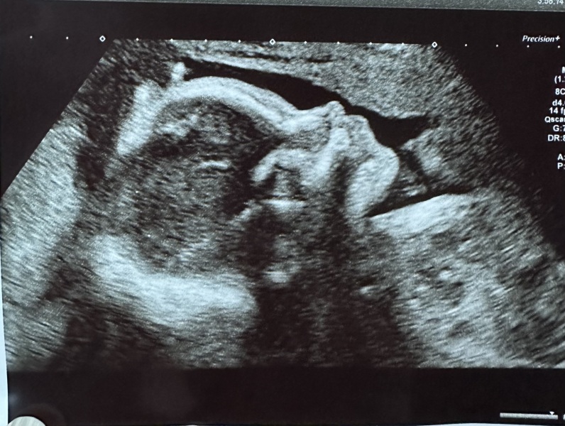 Due February 2024 Thread 5!! 🤰🩷💙