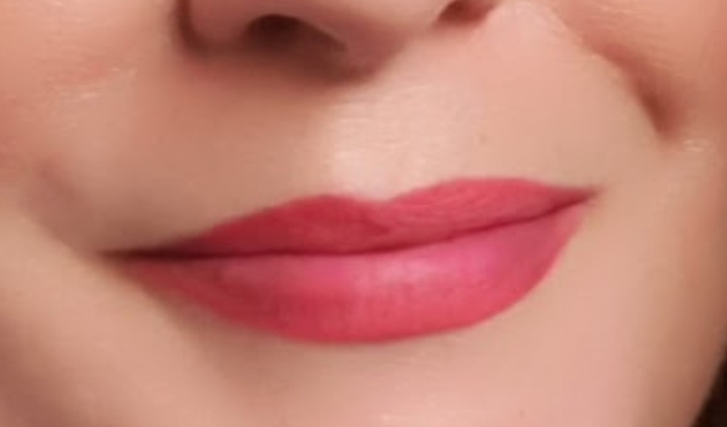 What is with lip fillers?!? They look so fake and awful