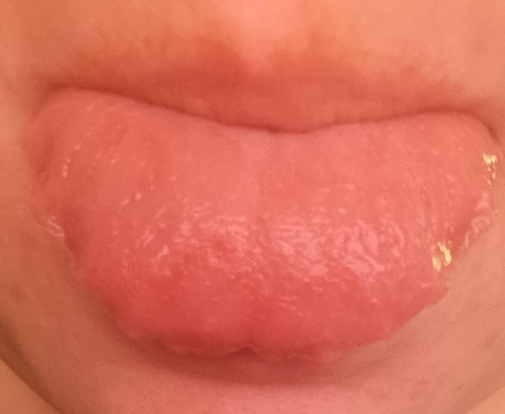 What the bloody hell is wrong with my tongue! Starting to worry.