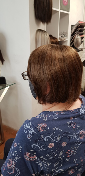 Male pattern hair loss - what are you doing about it ?